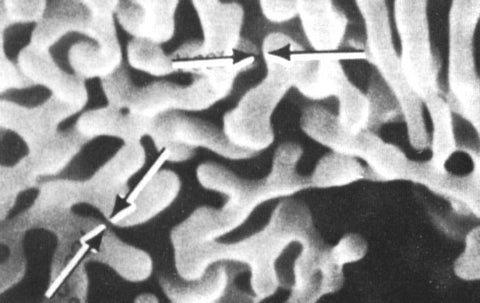 SEM aluminium tungsten dendrites