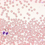 Differential quik III staining kit, modified giemsa (DG)