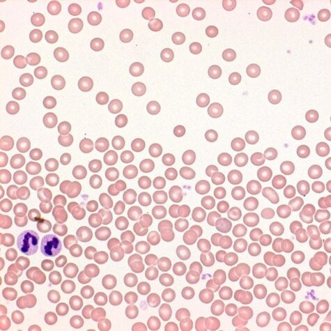 Differential quik III staining kit, modified giemsa (DG)