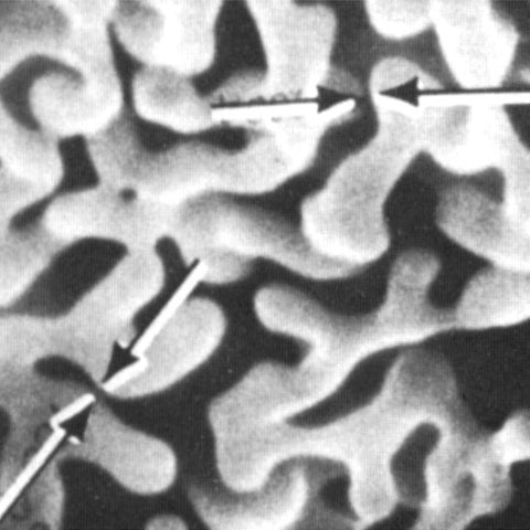 SEM aluminium tungsten dendrites, unmounted