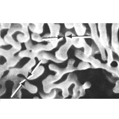 SEM aluminium tungsten dendrites, unmounted